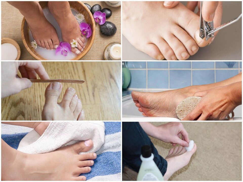 Prevent onychomycosis