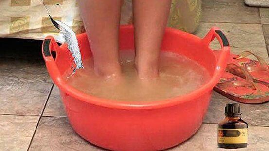 Taking a hot bath with iodine is one of the stages of treating onychomycosis