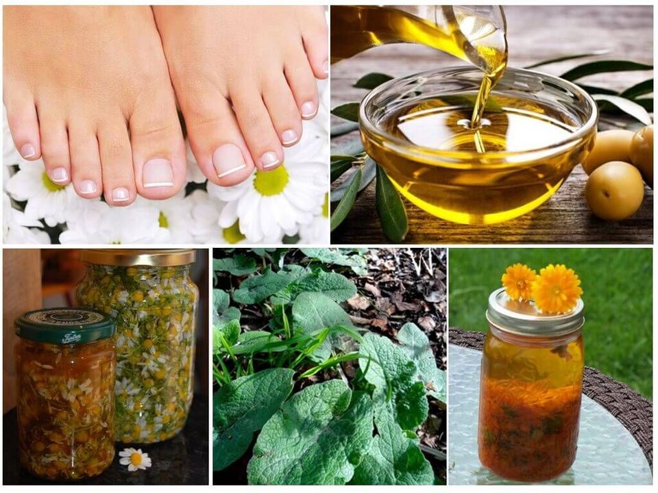 Folk recipes to fight onychomycosis