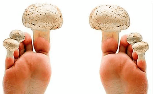 Fungus on nails
