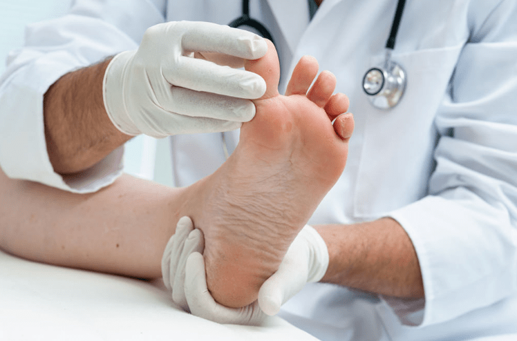 Treatment of nail fungi
