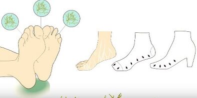 Prevent toe fungus