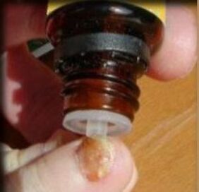 Apply drops to fungal infected toenails